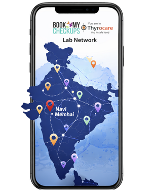 Mobile App